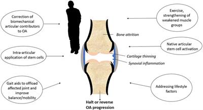 The Hunt Is On! In Pursuit of the Ideal Stem Cell Population for Cartilage Regeneration